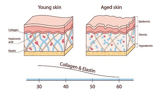 Colágeno en la piel. Ilustración del proceso de envejecimiento de la piel.