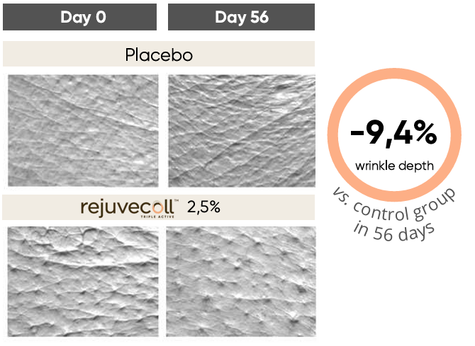 Imágenes comparativas de la piel antes y después de 56 días de tratamiento con Rejuvecoll™ al 2,5 %, mostrando una reducción de la profundidad de las arrugas frente al placebo.